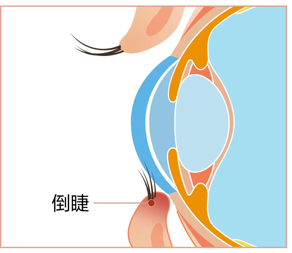 圖片.png